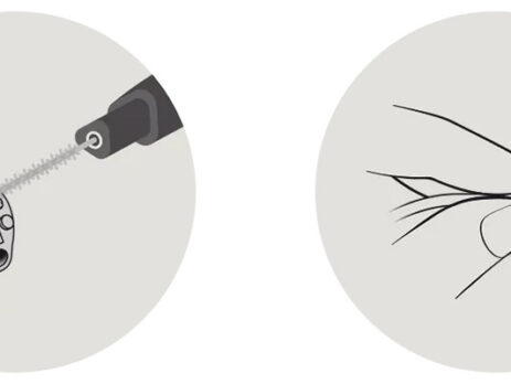 Η φροντίδα των ακουστικών σας